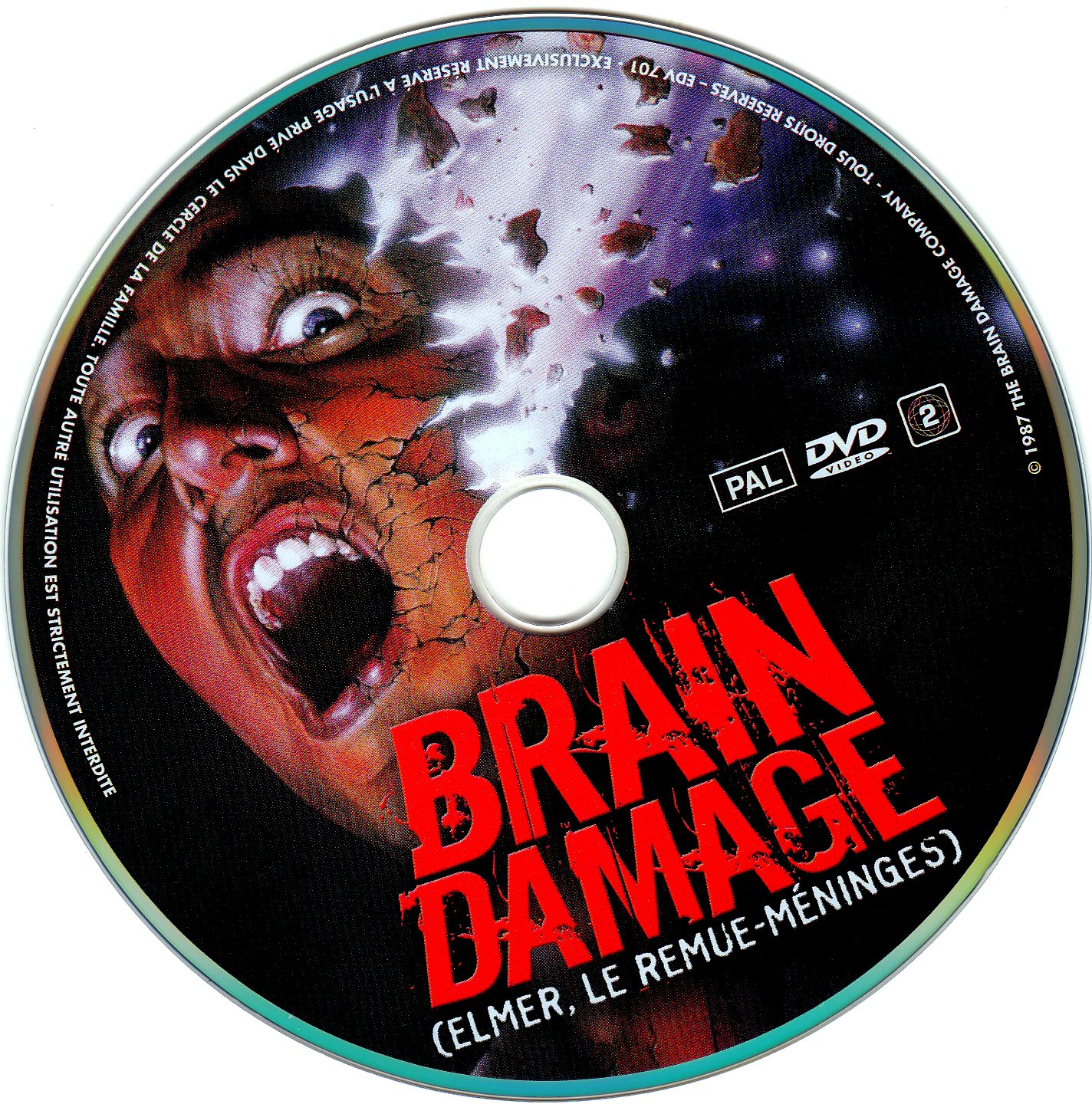 Brain damage