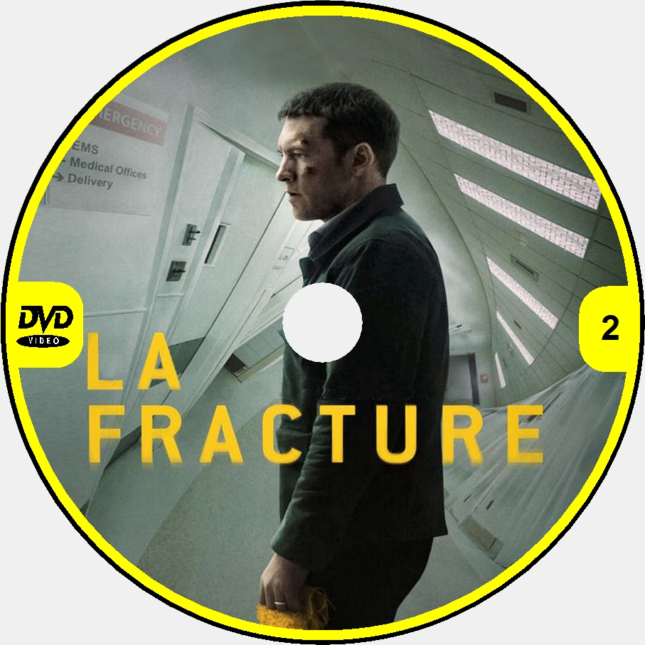 La fracture custom