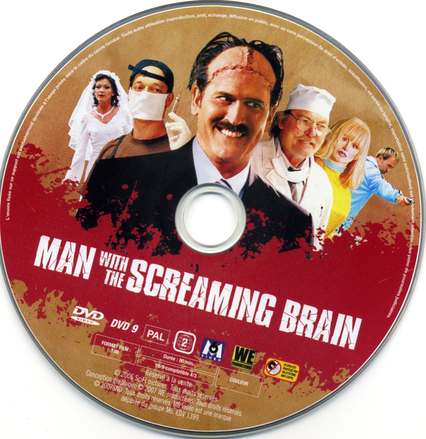 Man with a screaming brain