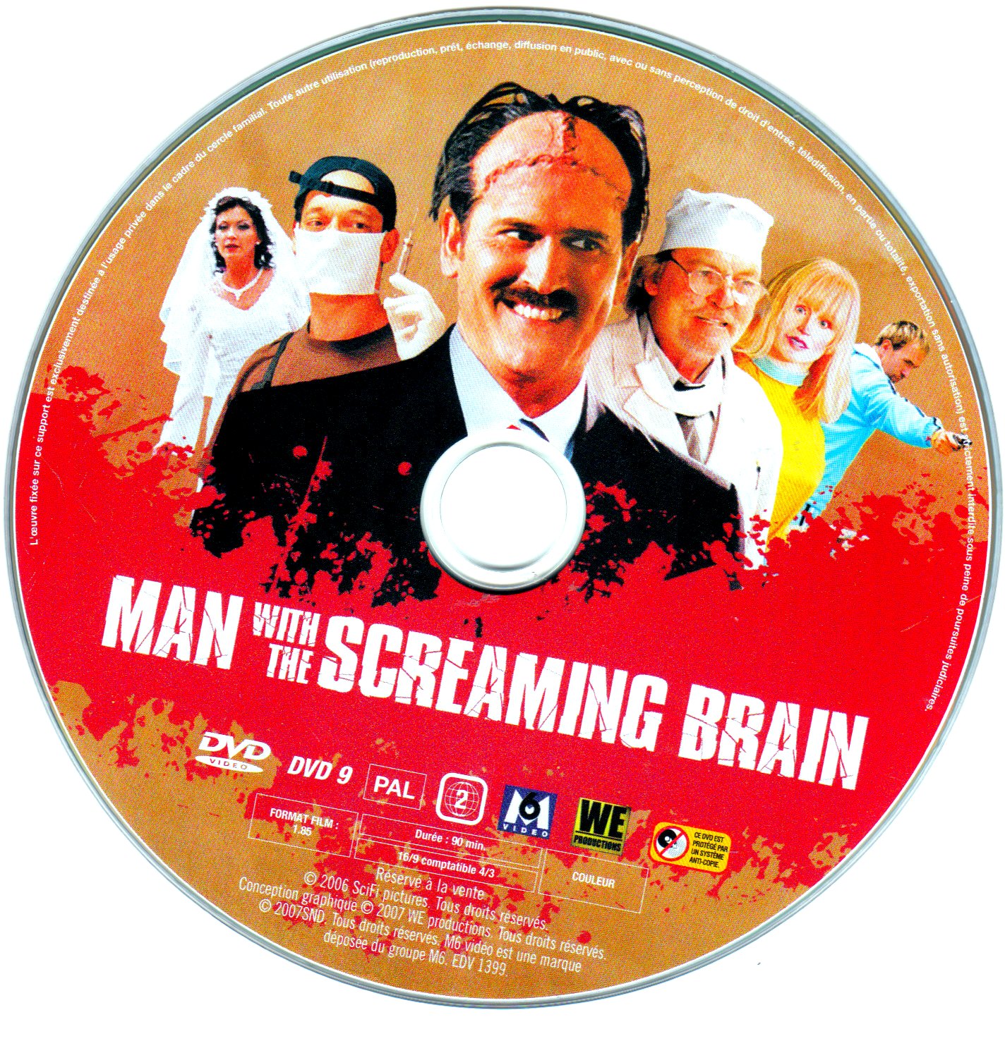 Man with the screaming brain